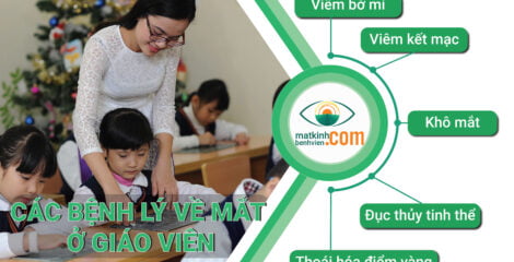 Các bệnh lý về mắt ở giáo viên